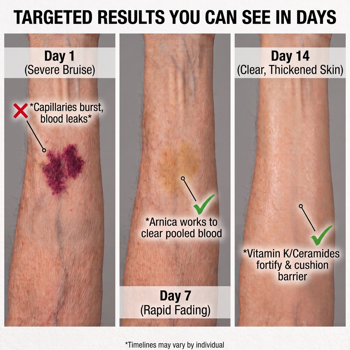 Serenyn™ Bruise Defense & Repair Serum