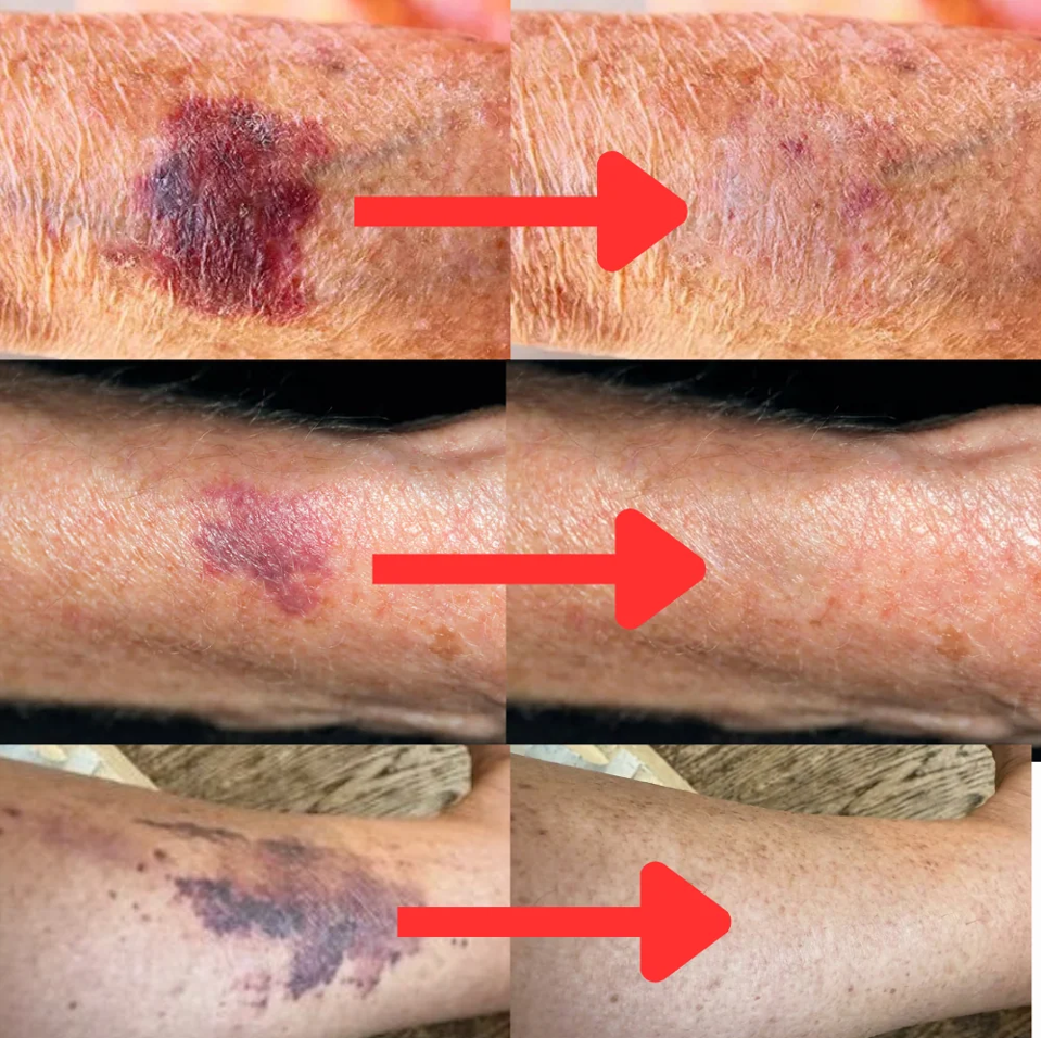 Serenyn™ Skin Recovery Serum
